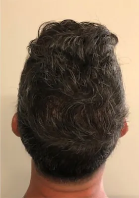 Nick Alberto latest crown view