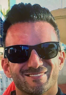 Nick Alberto latest front view hair restoration