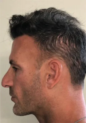 Nick Alberto latest left side view