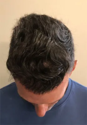Nick Alberto latest tilt view