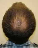 Ryan Crown View - Before