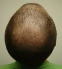Ryan Crown View - 12 Days