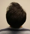 Ryan Crown View - 9 Months