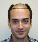Ryan Front View - Target Area