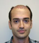 Ryan Front View - Right After