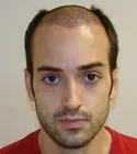 Ryan Front View - 4 Days