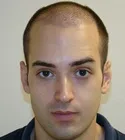 Ryan Front View - 9 Days