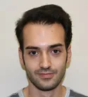 Ryan hair restoration progress at nine months