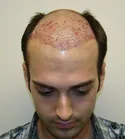 Ryan Front Tilt - Right After