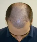Ryan Front Tilt - 7 Days