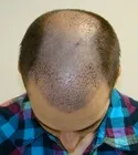 Ryan Front Tilt - 8 Days