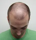 Ryan Front Tilt - 12 Days