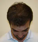 Ryan Front Tilt - 8 Months
