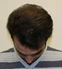 Ryan Front Tilt - 9 Months