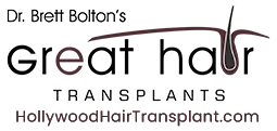 Great Hair Transplants